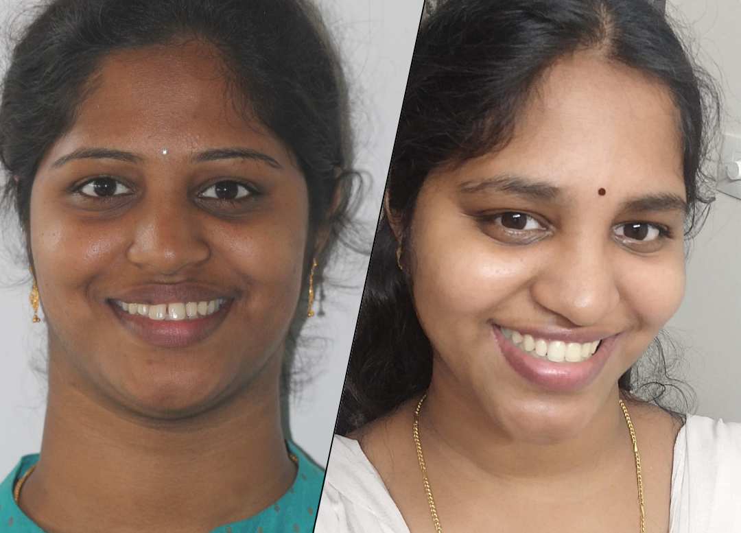 Rayapati story